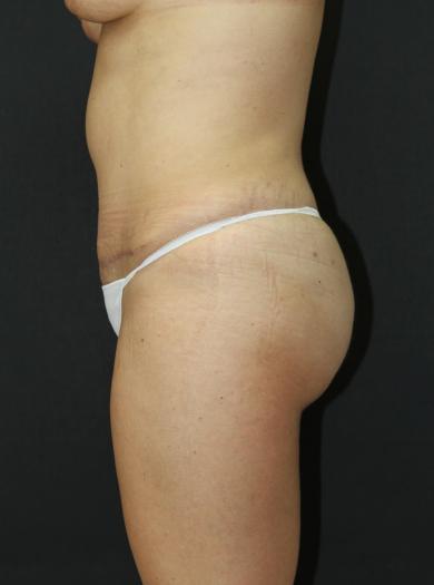 Main Photo Gallery, Case 6752, After Treatment