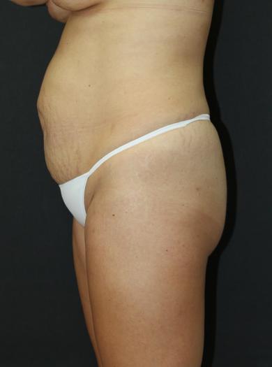 Main Photo Gallery, Case 6752, Before Treatment 