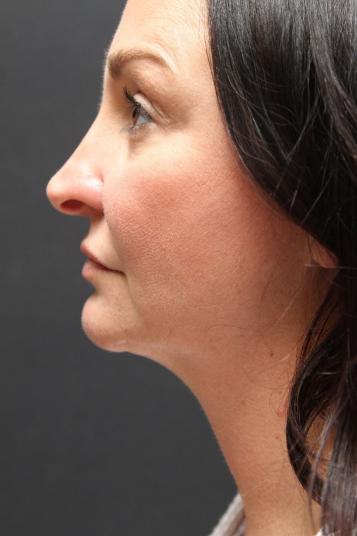 Main Photo Gallery, Case 6753, After Treatment