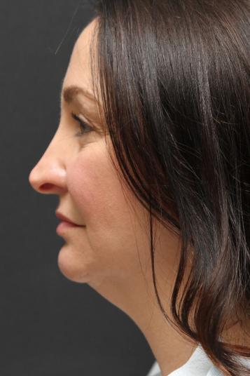 Main Photo Gallery, Case 6753, Before Treatment 