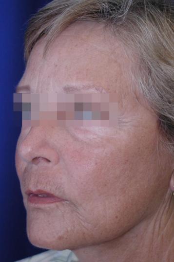 Main Photo Gallery, Case 6490, After Treatment