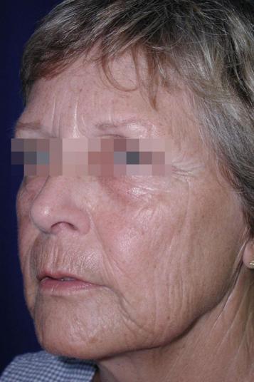 Main Photo Gallery, Case 6490, Before Treatment 