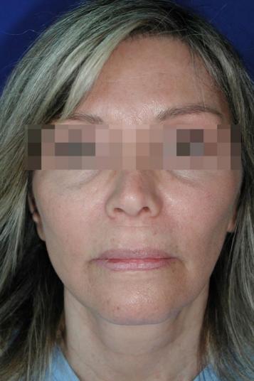 Main Photo Gallery, Case 6505, After Treatment