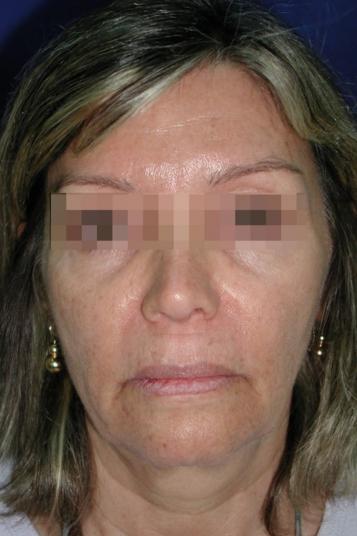 Main Photo Gallery, Case 6505, Before Treatment 