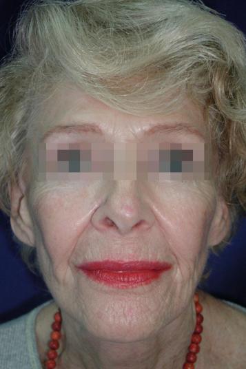 Main Photo Gallery, Case 6560, After Treatment