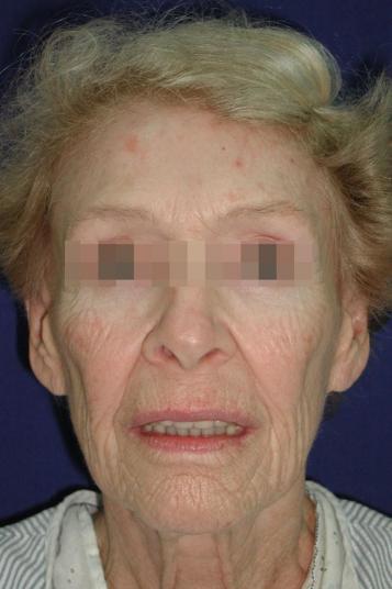 Main Photo Gallery, Case 6560, Before Treatment 