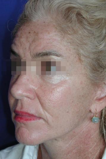 Main Photo Gallery, Case 6548, After Treatment