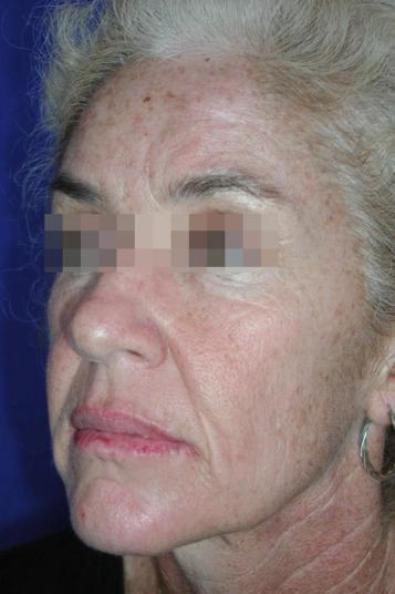 Main Photo Gallery, Case 6548, Before Treatment 