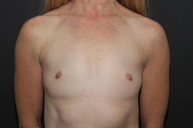 Main Photo Gallery, Case 6757, Before Treatment 