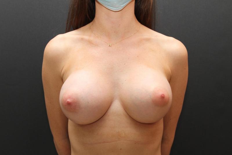 Main Photo Gallery, Case 6758, After Treatment