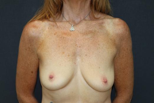 Main Photo Gallery, Case 6759, Before Treatment 