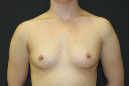 Main Photo Gallery, Case 6762, Before Treatment 