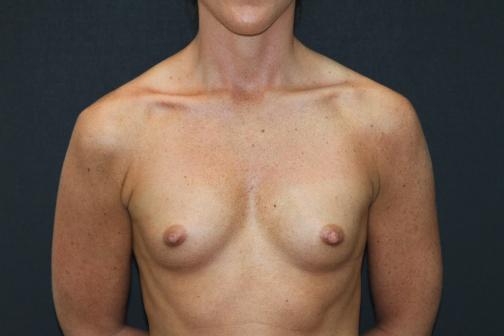 Main Photo Gallery, Case 6763, Before Treatment 