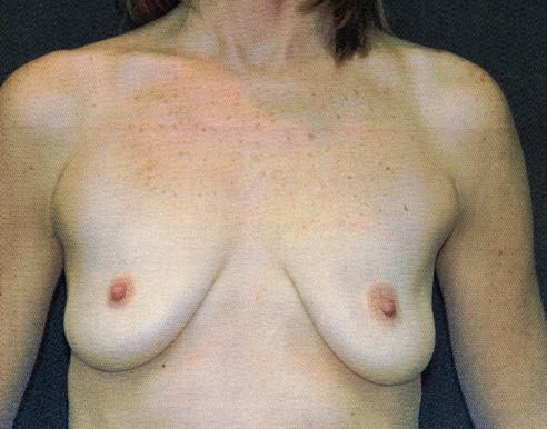 Main Photo Gallery, Case 6765, Before Treatment 