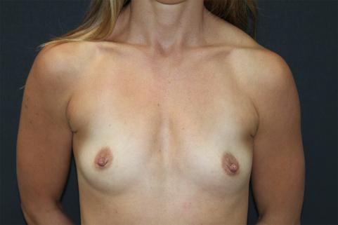 Main Photo Gallery, Case 6767, Before Treatment 