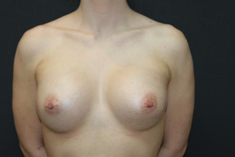 Main Photo Gallery, Case 6769, After Treatment