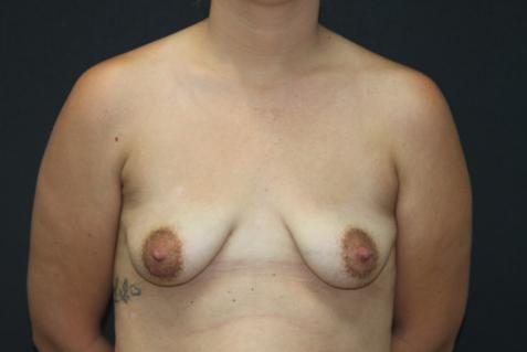 Main Photo Gallery, Case 6771, Before Treatment 