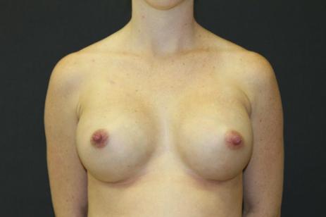 Main Photo Gallery, Case 6778, After Treatment