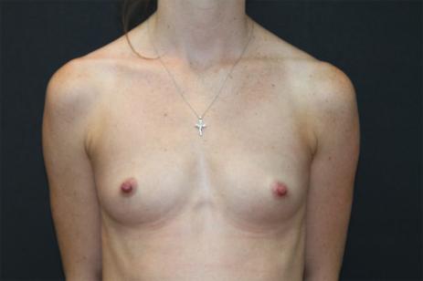 Main Photo Gallery, Case 6778, Before Treatment 