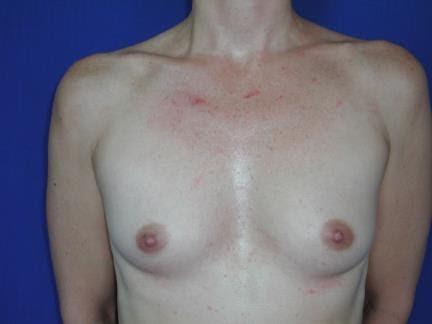 Main Photo Gallery, Case 6779, Before Treatment 