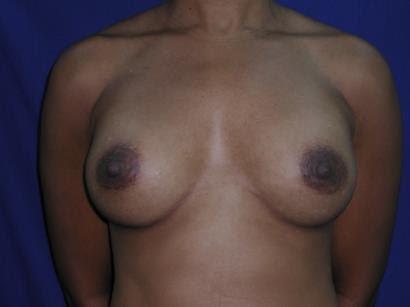 Main Photo Gallery, Case 6783, After Treatment
