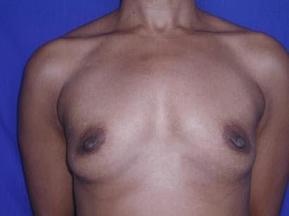 Main Photo Gallery, Case 6783, Before Treatment 