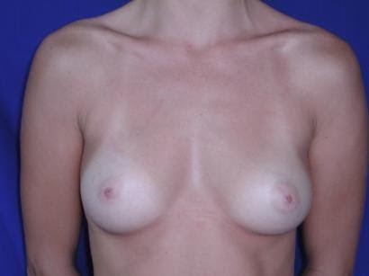 Main Photo Gallery, Case 6784, Before Treatment 