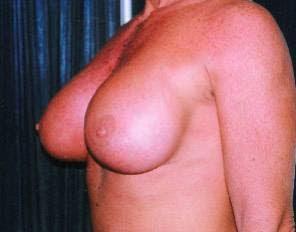 Main Photo Gallery, Case 6786, After Treatment