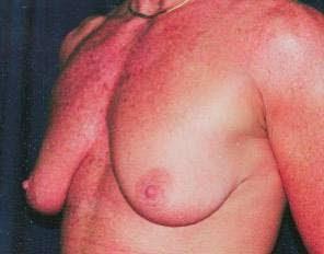 Main Photo Gallery, Case 6786, Before Treatment 