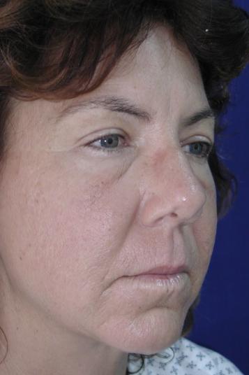 Main Photo Gallery, Case 6541, Before Treatment 