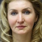 Face and Neck Rejuvenation Case 6481, After Treatment, Female Patient, Thumbnail 1