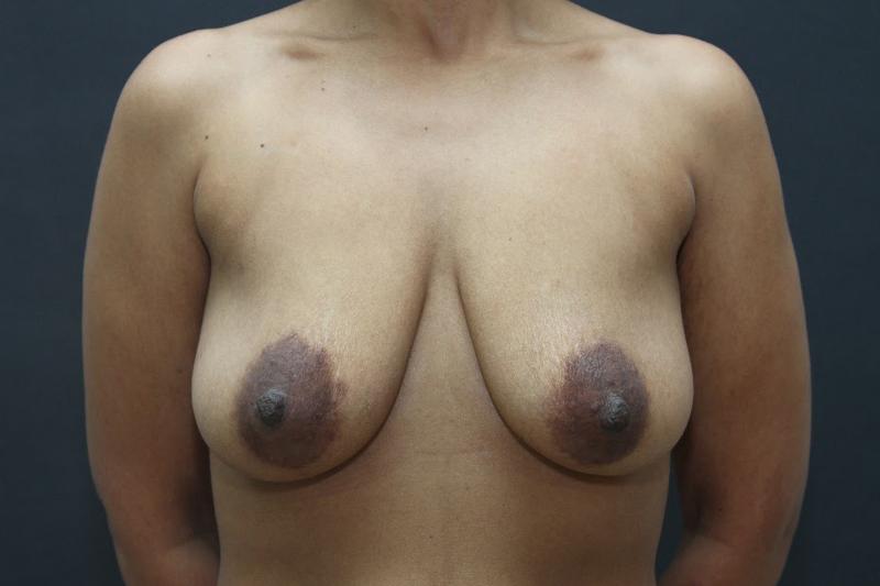 Main Photo Gallery, Case 6821, Before Treatment 