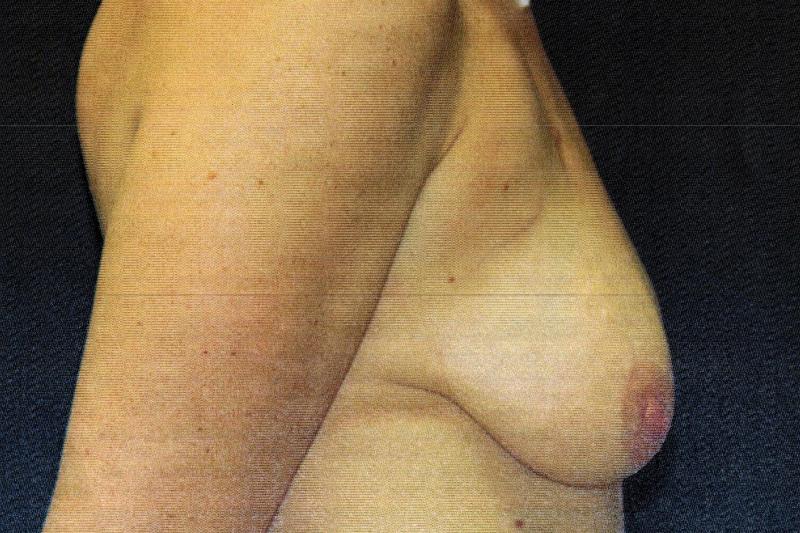 Main Photo Gallery, Case 6825, Before Treatment 
