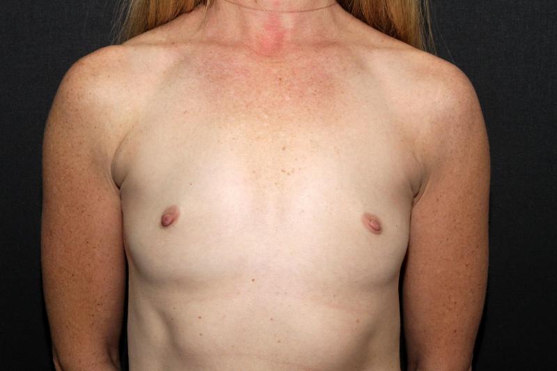 Main Photo Gallery, Case 6828, Before Treatment 