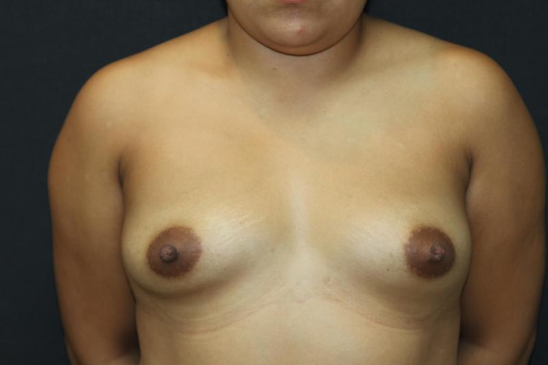 Main Photo Gallery, Case 6838, Before Treatment 
