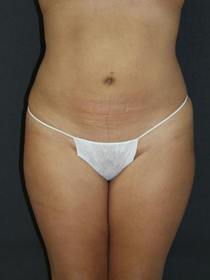 Main Photo Gallery, Case 6845, After Treatment