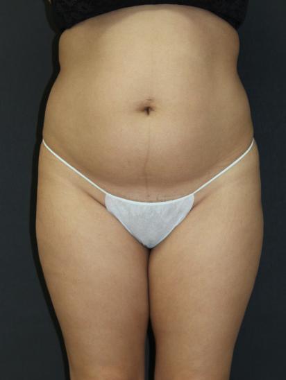 Main Photo Gallery, Case 6845, Before Treatment 