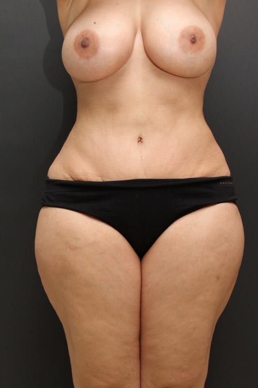 Main Photo Gallery, Case 6846, After Treatment