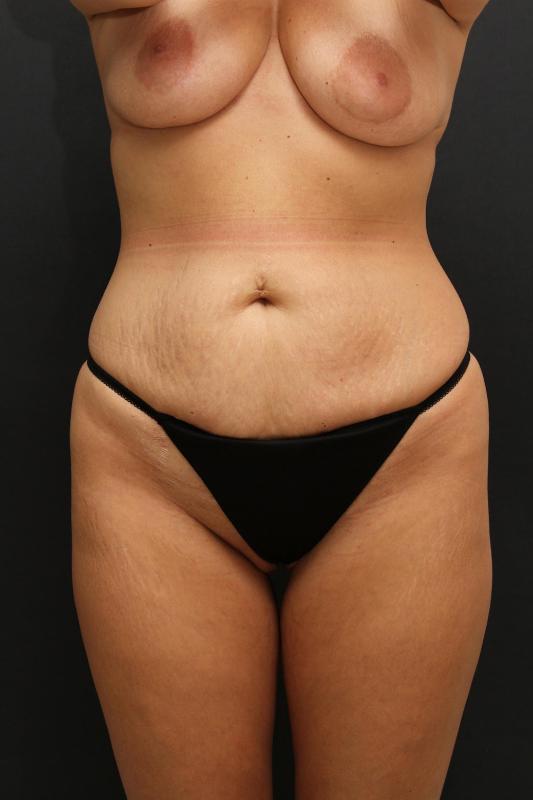 Main Photo Gallery, Case 6847, Before Treatment 