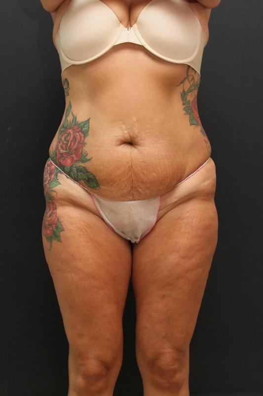 Main Photo Gallery, Case 6848, Before Treatment 