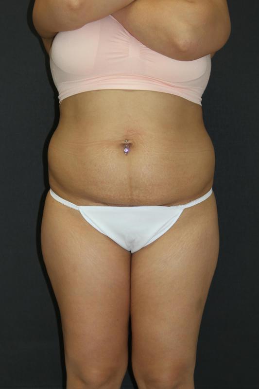Main Photo Gallery, Case 6849, Before Treatment 