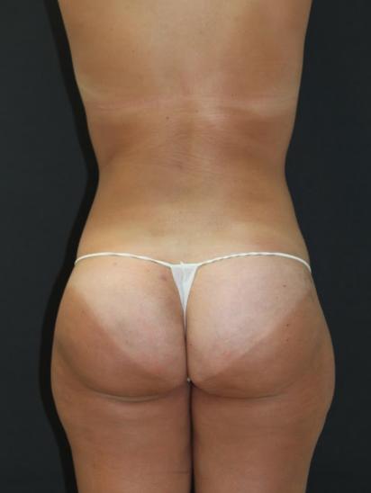Main Photo Gallery, Case 6850, After Treatment