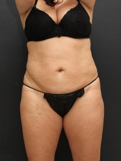Main Photo Gallery, Case 6851, Before Treatment 