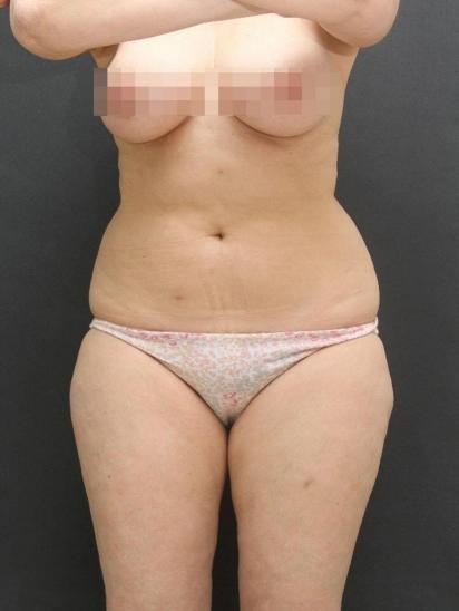 Main Photo Gallery, Case 6855, Before Treatment 
