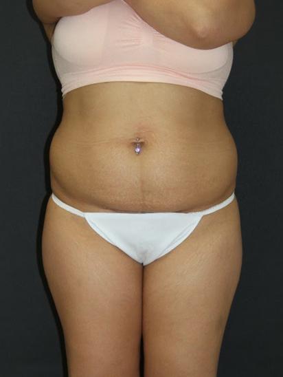 Main Photo Gallery, Case 6856, Before Treatment 