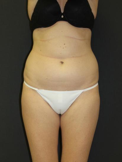 Main Photo Gallery, Case 6857, Before Treatment 