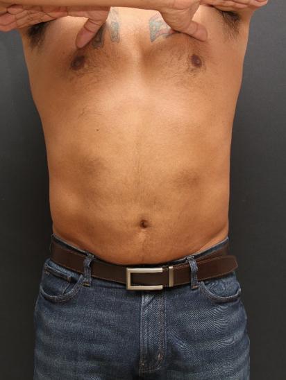 Main Photo Gallery, Case 6858, After Treatment