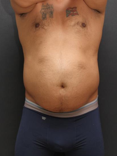 Main Photo Gallery, Case 6858, Before Treatment 