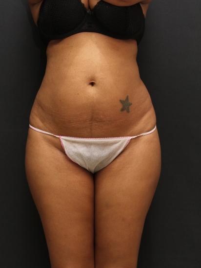 Main Photo Gallery, Case 6859, Before Treatment 
