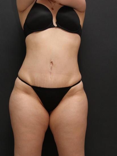 Main Photo Gallery, Case 6860, After Treatment